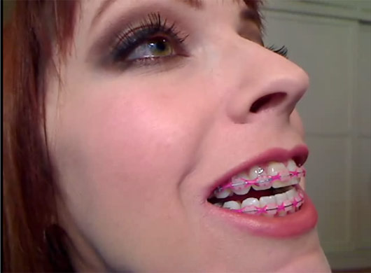 Emily Marilyn braces fetish video clips cum on my braces